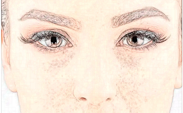 寧波美苑整形醫(yī)院雙眼皮開眼角技術(shù)怎么樣?價(jià)格一覽表?120天案例揭秘