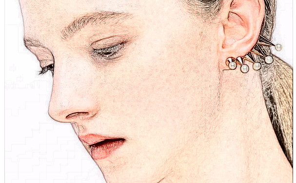 孝感天妃整形扇形雙眼皮技術怎么樣?費用標準?三個月案例恢復過程