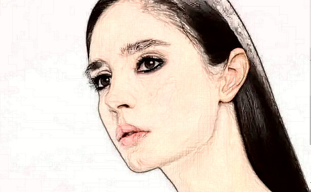 大連市星妍醫(yī)療美容診所新月雙眼皮技術(shù)評測怎么樣?術(shù)后半年案例揭秘