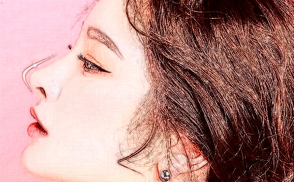 福州比華利美容醫(yī)院植發(fā)怎么樣?報價多少?案例欣賞&技術(shù)點評