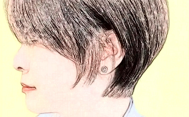 上海葦渡醫(yī)療 PherriMed植發(fā)技術(shù)怎么樣?多少錢?心動案例