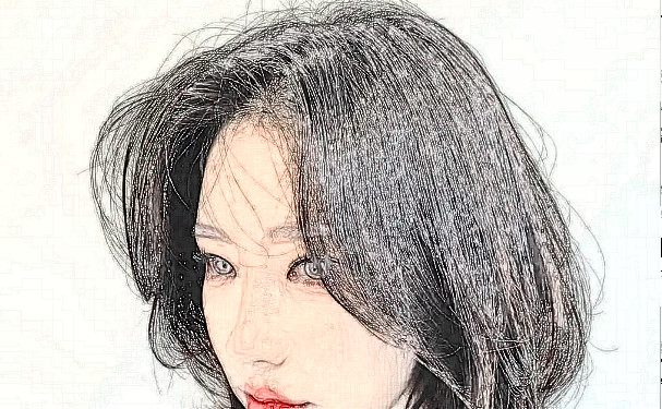 常德愛思特醫(yī)療美容門診部種植頭發(fā)150天術(shù)后案例展示&價格?