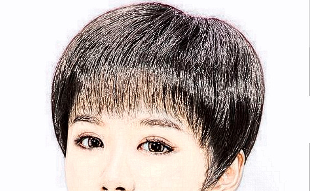 碧蓮盛美學(xué)植發(fā)（寧波分院）植發(fā)120天野生案例|技術(shù)評價怎么樣?價格查詢