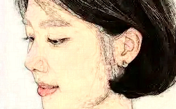 長沙華韓華美醫(yī)療美容醫(yī)院植發(fā)技術(shù)怎么樣?報價多少?案例曝光