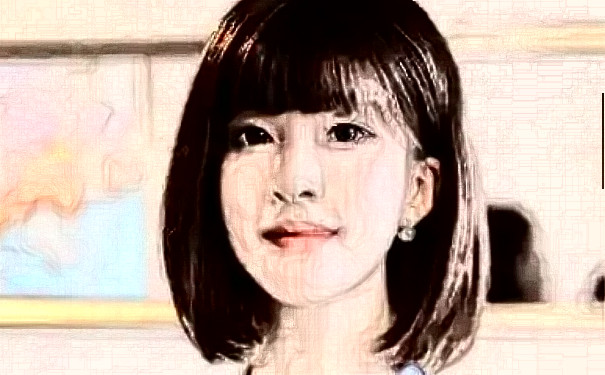 青島熙朵醫(yī)療美容診所植發(fā)術后三個月案例曝光&技術怎么樣?