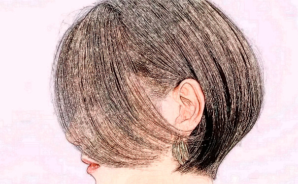 南昌萊美美容醫(yī)院植發(fā)費用明細?半年案例恢復(fù)過程