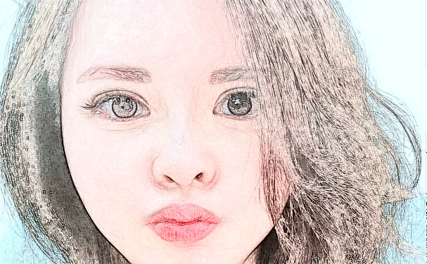 鹽城艾美莉整形美容醫(yī)院脂肪填充怎么樣價(jià)格明細(xì)術(shù)后90天案例&技術(shù)等級(jí)