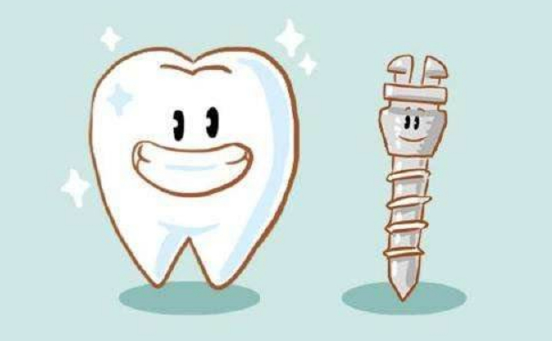 北京天壇醫(yī)院白保晶種植牙技術(shù)優(yōu)勢怎么樣?經(jīng)驗案例