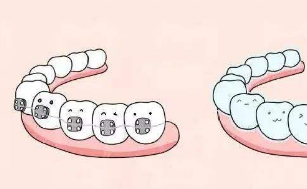 濱州醫(yī)學(xué)院附屬醫(yī)院王青山整牙變美案例&技術(shù)怎么樣?