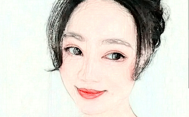 單縣中心醫(yī)院張彪激光美白祛斑技術特點怎么樣?術后案例&疑問解答