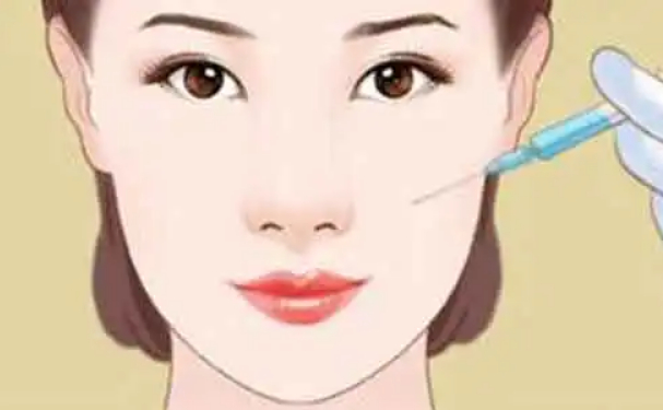 山東省立醫(yī)院孟真鼻唇溝填充120天案例欣賞(效果怎么樣?技術(shù)水準)