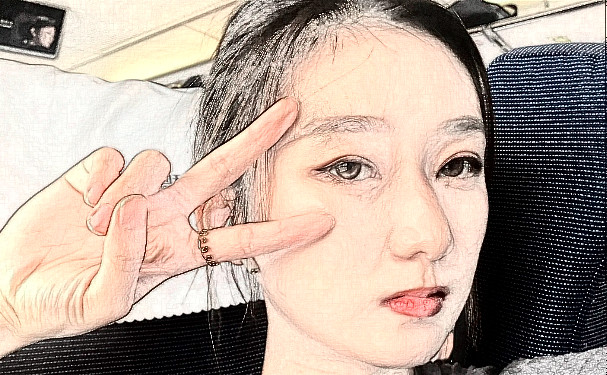 山東省立醫(yī)院欒保華隆鼻報價多少?案例點評,醫(yī)生介紹