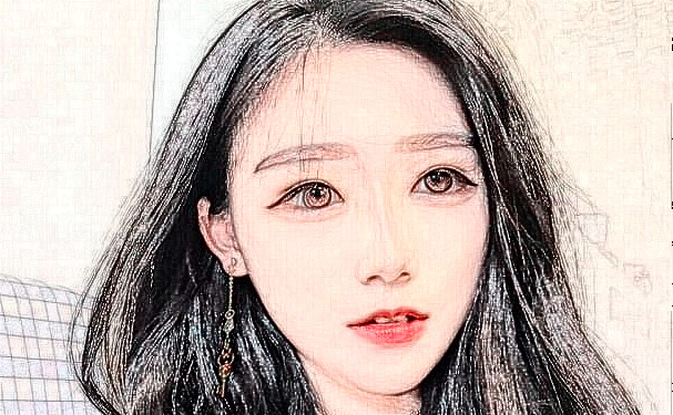 運城市中心醫(yī)院岳長路太陽凹陷整形手術術后案例&價格明細?