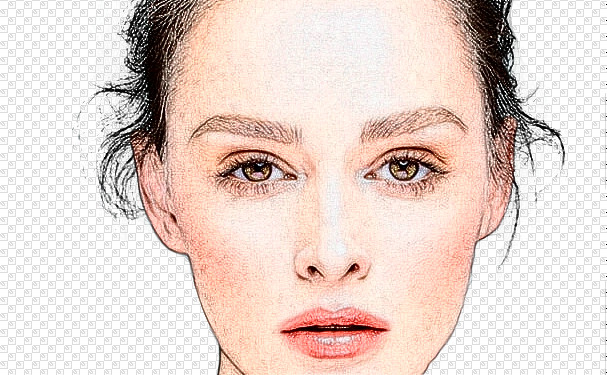 運城市中心醫(yī)院岳長路太陽凹陷整形手術術后案例&價格明細?