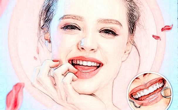 赤峰學院附屬醫(yī)院種植牙手術120天術后恢復案例(效果怎么樣?技術優(yōu)點)