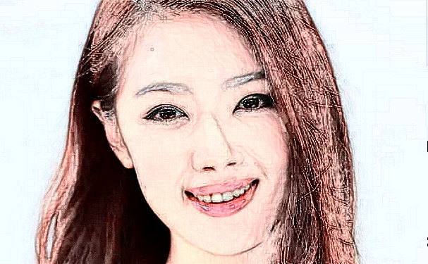 臨沂市人民醫(yī)院李玉柱激光美容祛斑價格明細?術(shù)后6個月案例,醫(yī)生介紹