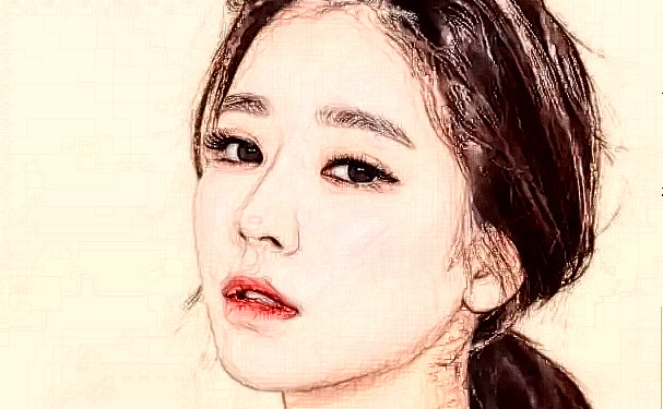 鄭州大學(xué)第一附屬醫(yī)院崔文光牙套正畸90天案例恢復(fù)過程(效果怎么樣?技術(shù)亮點(diǎn))