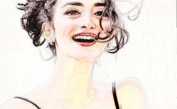 首都醫(yī)科大學附屬北京世紀壇醫(yī)院尹宏宇牙齒擁擠矯正技術怎么樣?多少錢?恢復案例