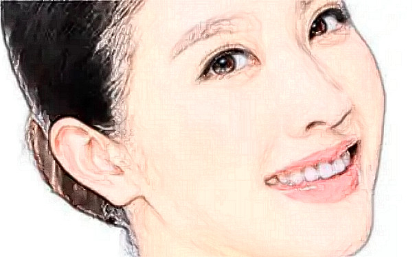 常州市第一人民醫(yī)院玻尿酸隆鼻技術(shù)點(diǎn)評怎么樣?恢復(fù)案例