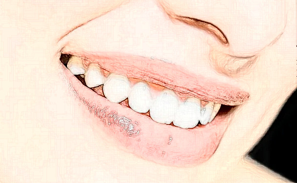 浙江普陀醫(yī)院進(jìn)口牙套矯正經(jīng)驗(yàn)案例|技術(shù)優(yōu)勢怎么樣?口碑反饋