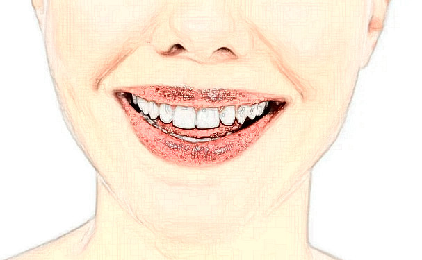 上海市中西醫(yī)結合醫(yī)院前牙種植牙技術特點怎么樣?野生案例&口碑詳情